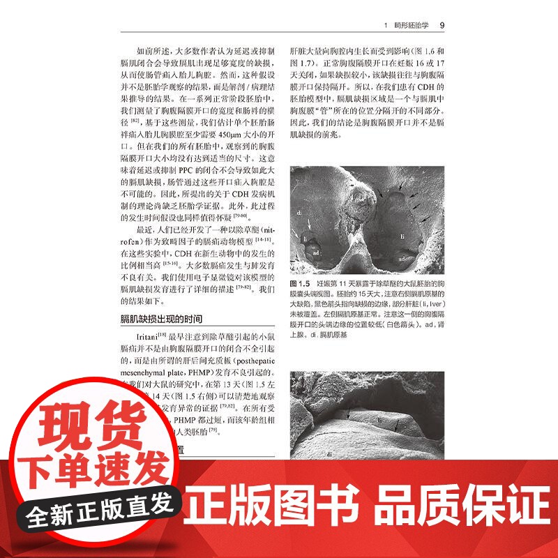 新生儿外科学 第4四版 舒强 钭金法 主译 阐述了新生儿外科疾病的特点 涵盖诊疗要点 临床精华 鉴别诊断等 儿科学 人民高清大图