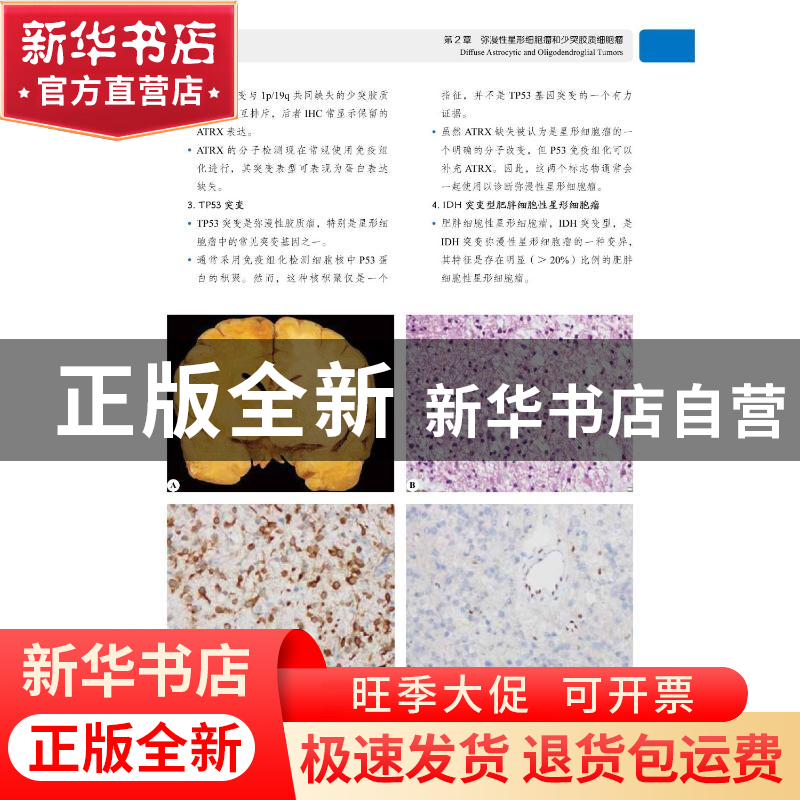 正版 神经病理诊断精要 [印]Chitra Sarkar 中国科学技术出版社 9高清大图