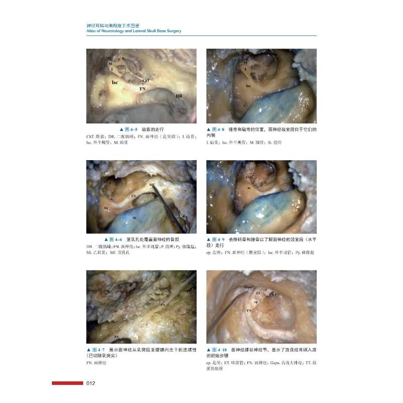 醉染图书神经耳科与侧颅底手术图谱(精)9787504693129高清大图