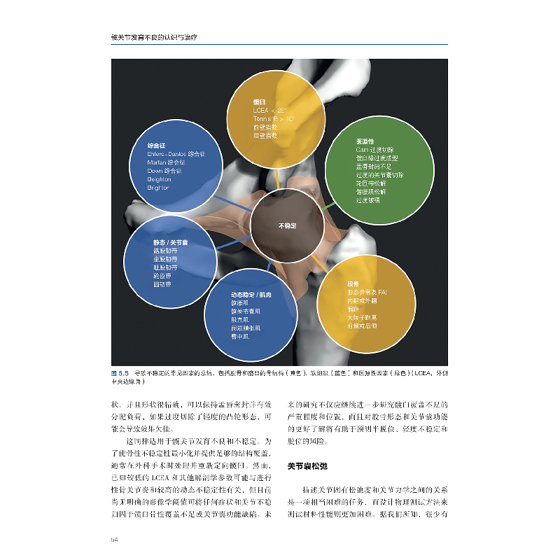 醉染图书髋关节发育不良的认识与治疗9787559117175高清大图