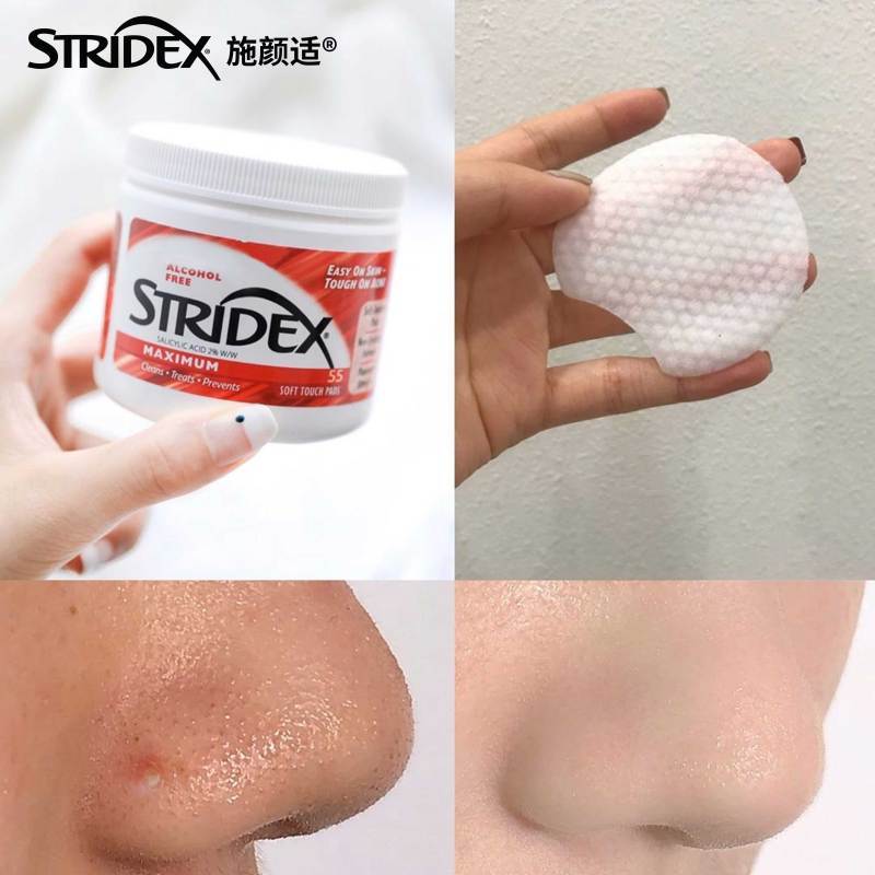 施颜适Stridex水杨酸祛痘棉片套装(55片+6ml)控油收缩毛孔抗痘痘闭口 滋养润唇
