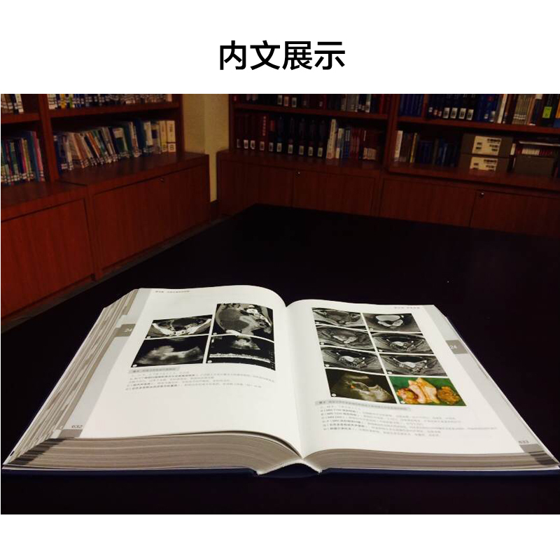 [醉染正版]肿瘤影像诊断图谱 第2版分享中国医学科学院肿瘤医院影像科多年宝贵的诊断与鉴别诊断经验周纯武赵心明主编影像医学