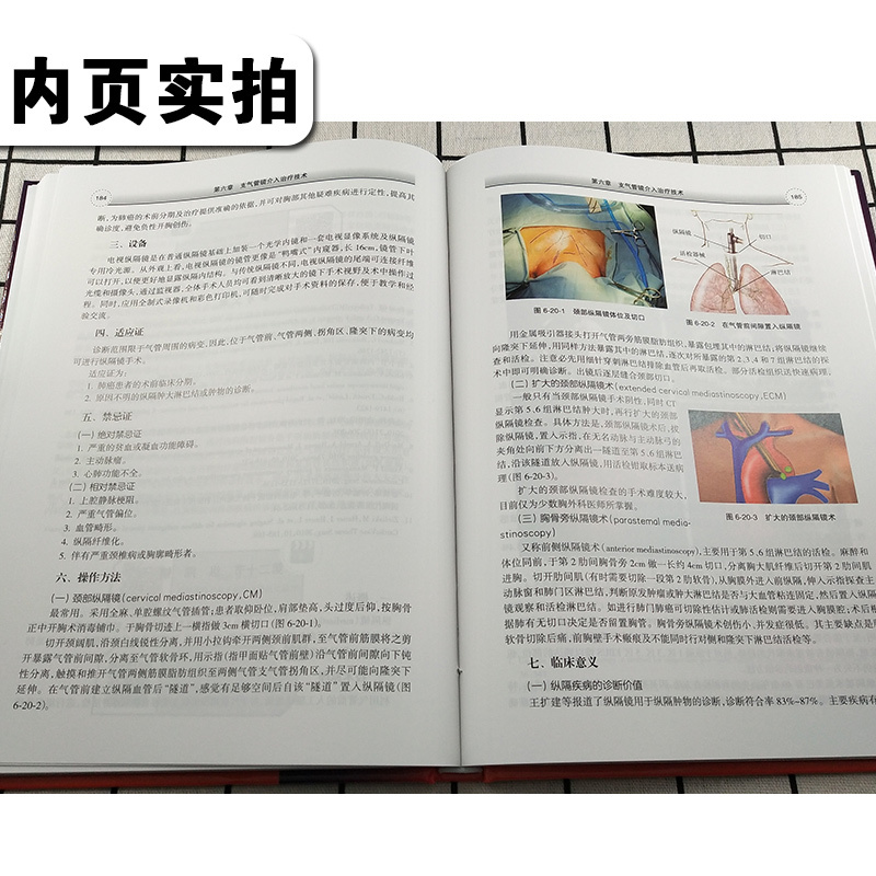 [正版] 支气管镜介入治疗第2版第二版 王洪武 金发光 柯明耀 呼吸内科学临床案例诊疗教程参考工具书籍 人民卫生出版社