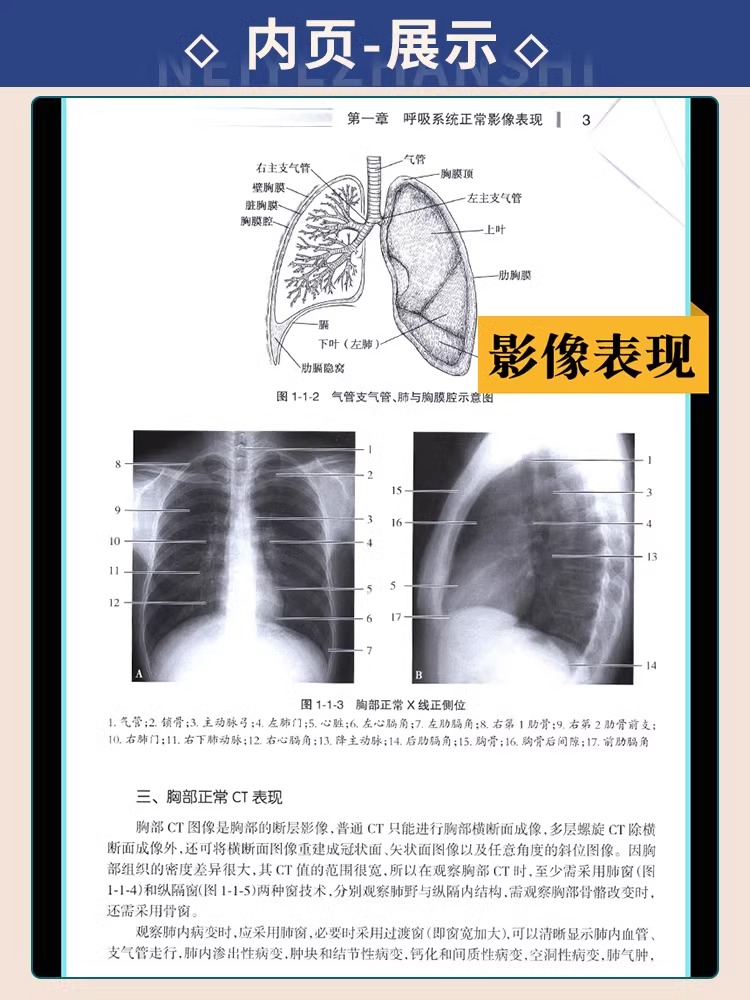 [正版]全套4本医学影像学读片诊断图谱胸部头颈腹部骨肌全4册放射医学诊断参考书X光CT MRI影像诊断指南初学教 胸部高清大图