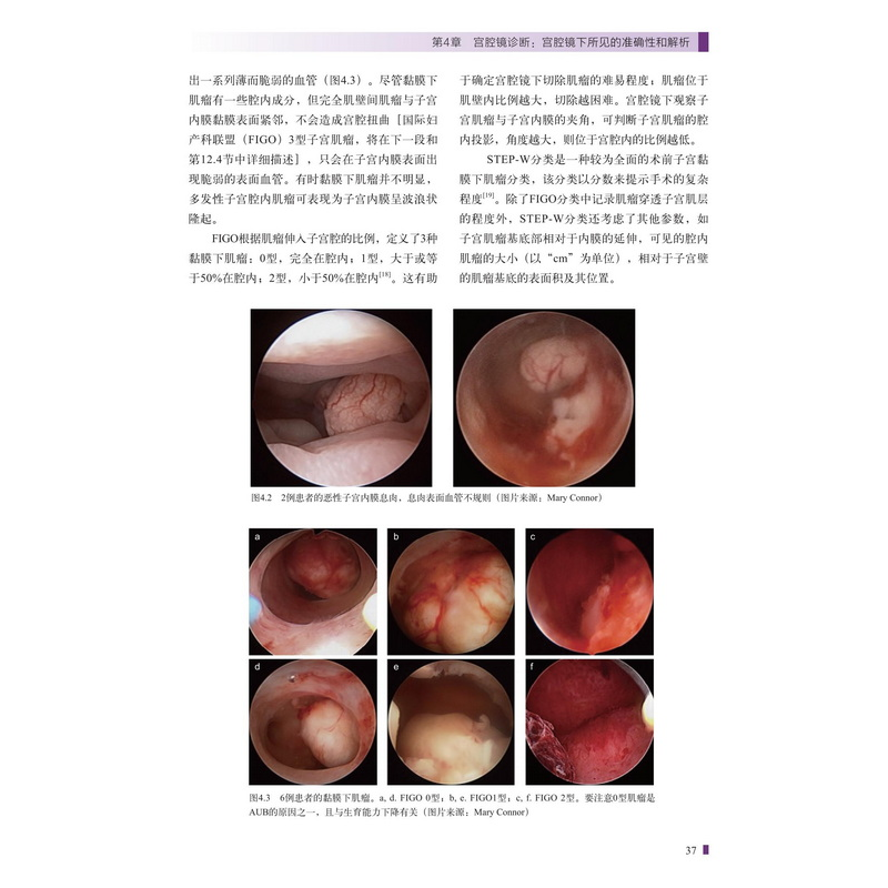 醉染图书宫腔镜的诊断及手术技巧9787571421670高清大图
