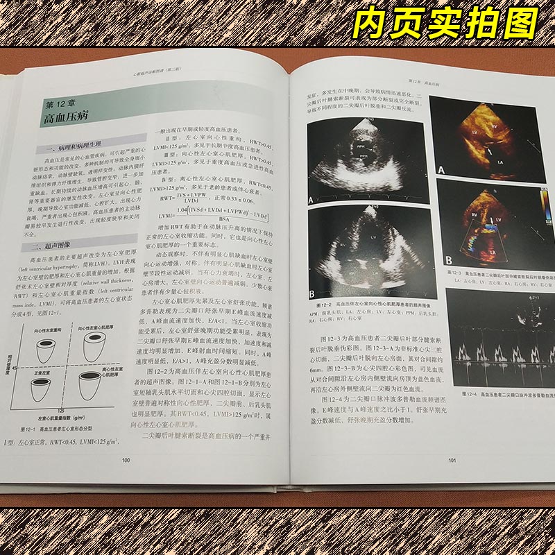 [醉染正版]正版 心脏超声诊断图谱 第二版 主编任卫东 张立敏 辽宁科学技术出版社9787559109224高清大图