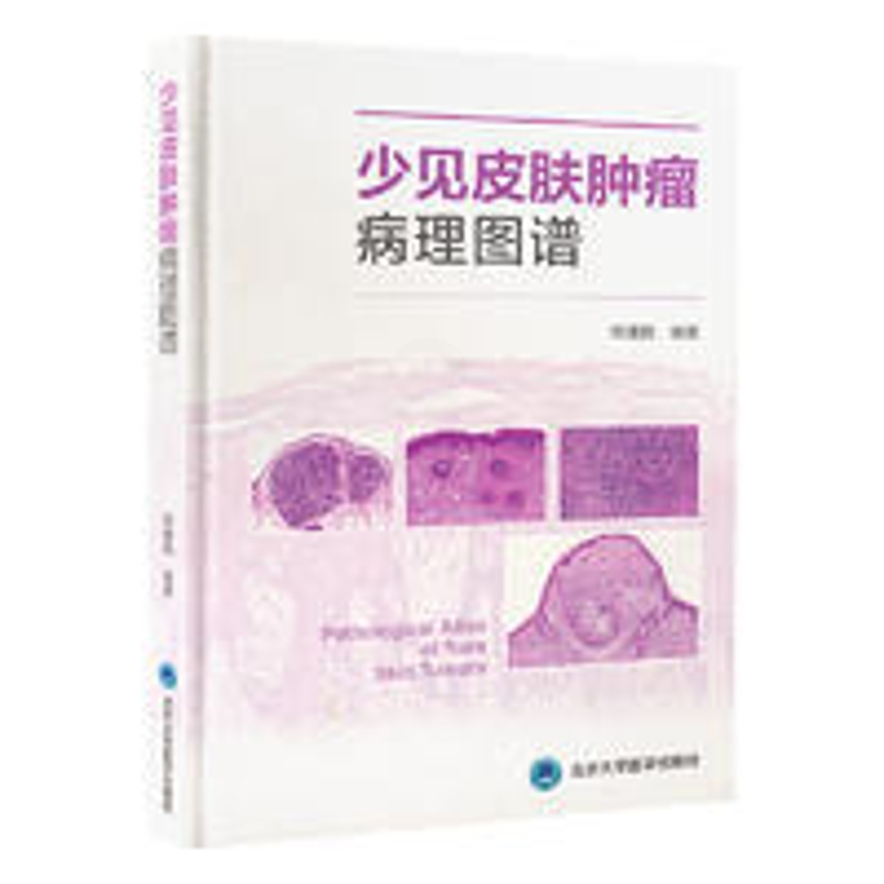 [醉染正版]正版 少见皮肤肿瘤病理图谱 常建民 北京大学医学出版社 适合皮肤科医师以及病理科医师参考使用 佩吉特样鲍恩病高清大图