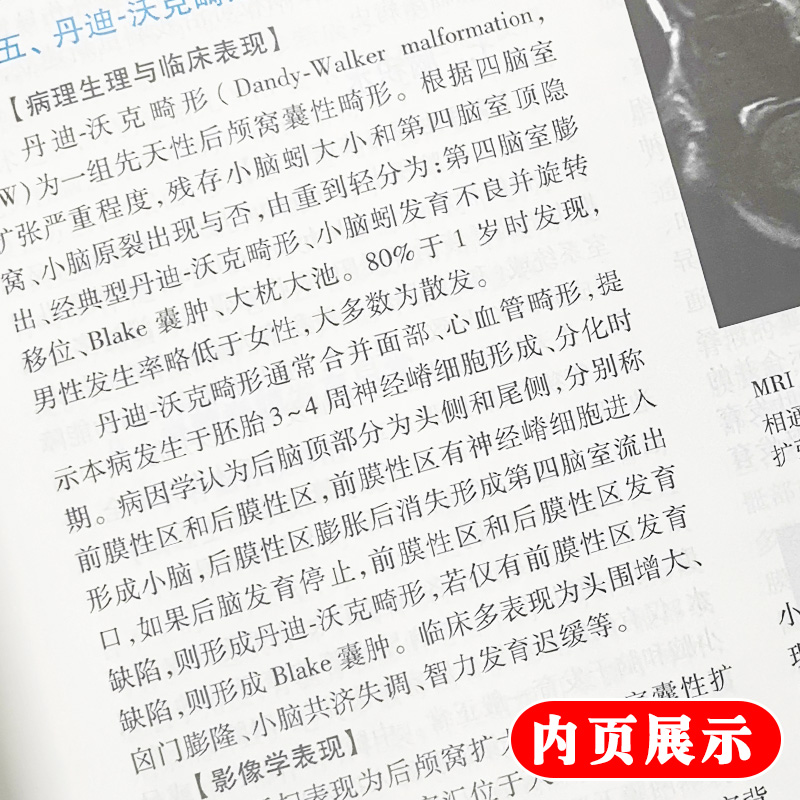 [正版] 导管相关感染防控Z佳护理实践专家共识 蔡虻 高凤莉主编 人民卫生出版社 中央静脉导管相关尿路防控指南 护高清大图