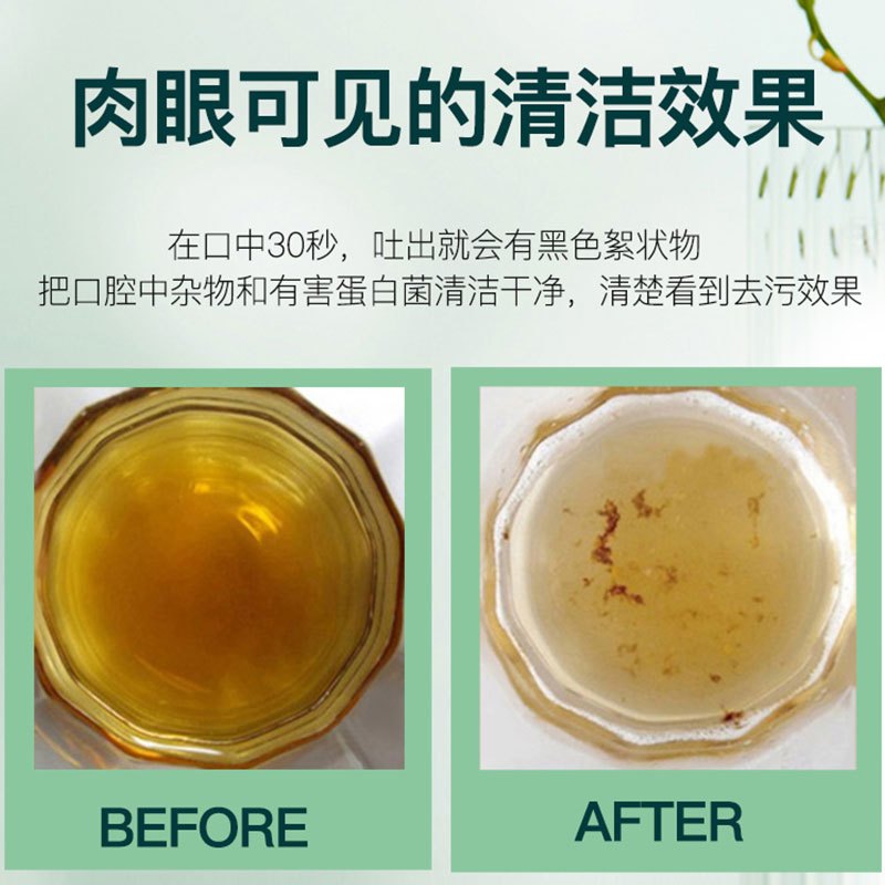 仁和(RENHE) 漱口水除口腔异味持久留香男女生口腔清洁护理便携柠檬味漱口水 健齿护龈清新漱口水 300ML/瓶