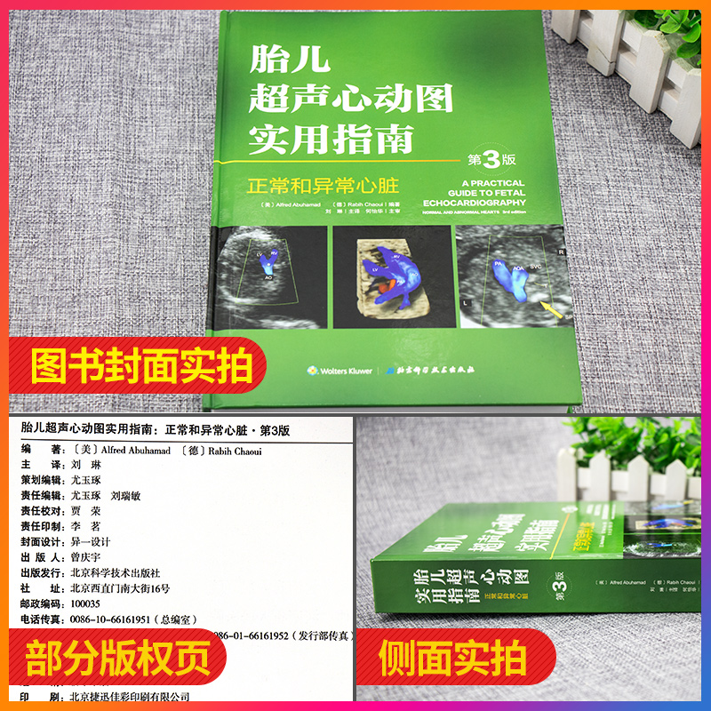 [正版]胎儿超声心动图实用指南 正常和异常心脏 第三版3 妇产科学 医学类书籍 胎儿心脏畸形诊断临床检查 刘琳 主译 北高清大图