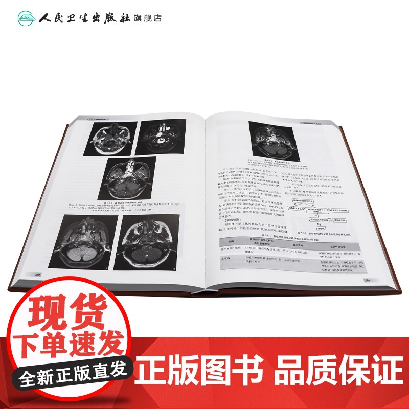 中华影像鉴别诊断学——头颈分册 2024年10月参考书高清大图