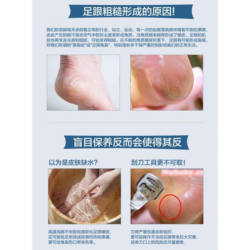 美国乐呋手脱皮套装乐防干裂脱皮脚裂膏呋脚后跟干裂龟裂霜手足美国原装套装