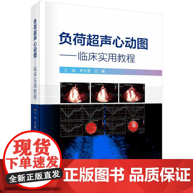 [按需印刷] 负荷超声心动图——临床实用教程高清大图