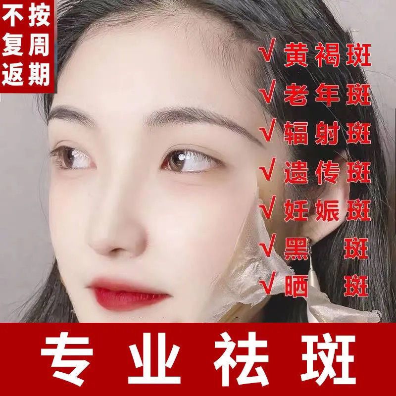 一盒装【小斑点使用】 去班黑斑色斑老年斑男士女专用祛斑霜斑点神器淡化黑色素沉淀脸部