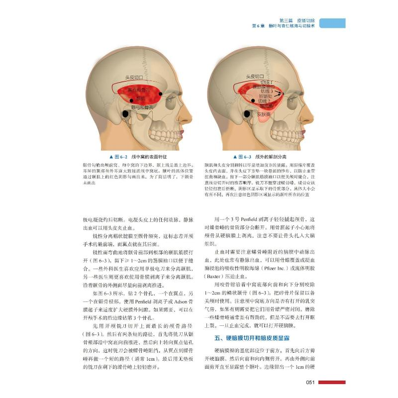 醉染图书癫痫外科手术技术 原书第2版9787504697042高清大图