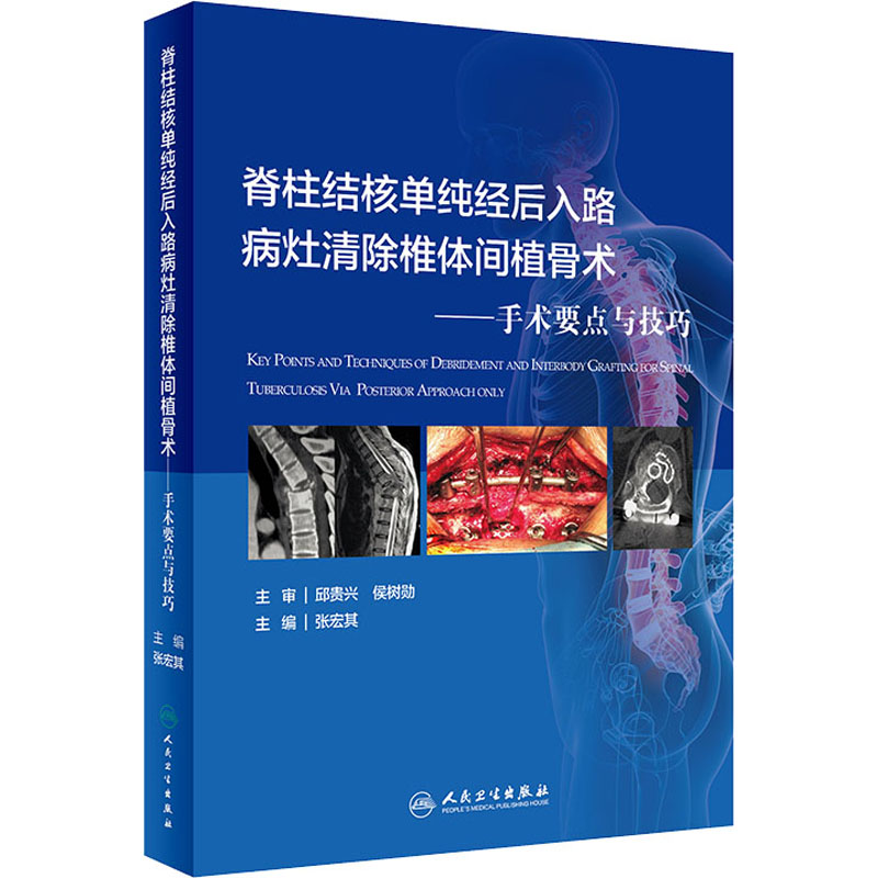 [M]脊柱结核单纯经后入路病灶清除与椎体间植骨术——手术要点与技巧-9787117313681高清大图