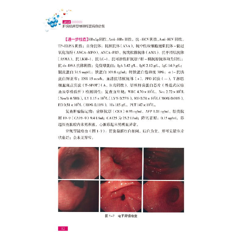醉染图书2018肝病临床思维训练营病例合集9787518959051高清大图