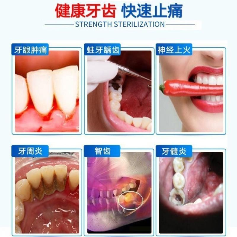 [2秒去痛]云南本草牙痛牙疼速效去蛀牙龈肿痛虫牙龋齿消炎喷剂 [专攻牙痛]消肿去火