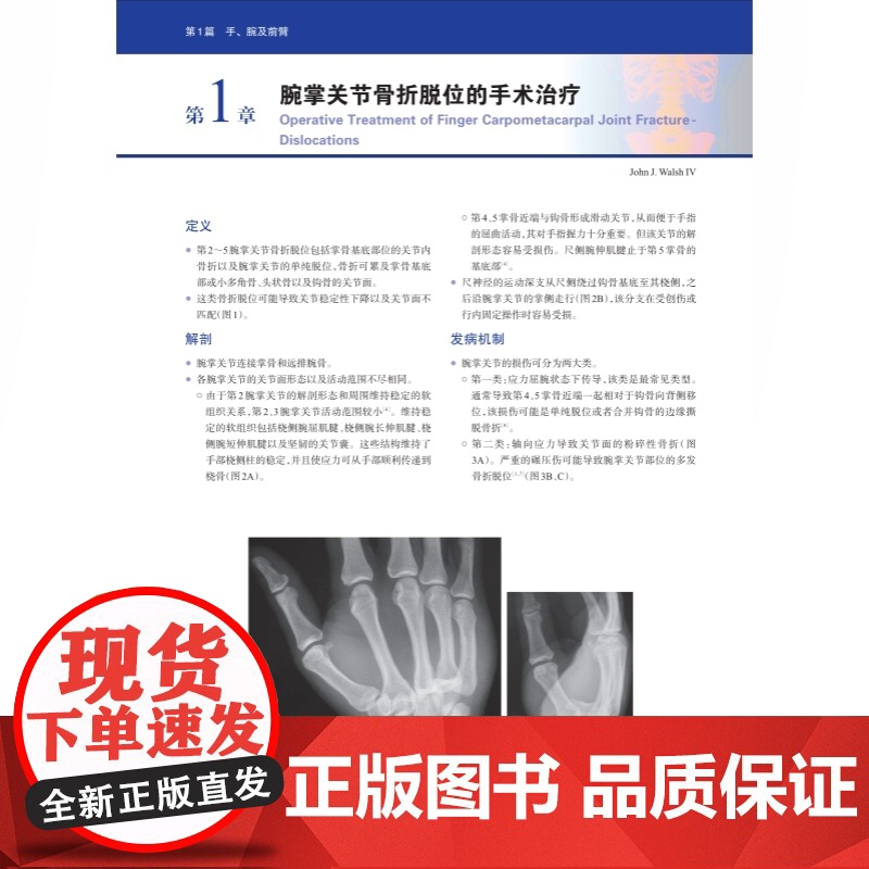 WIESEL骨科手术学·创伤外科 骨科手术技术精髓佳作手把手教学上海科学技术出版社高清大图