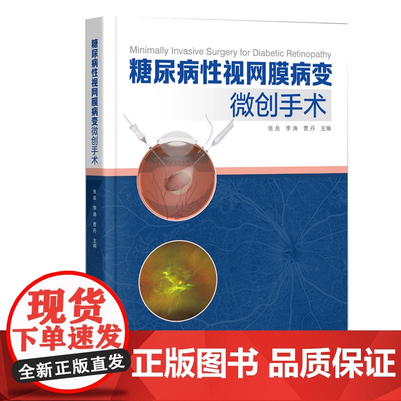 糖尿病性视网膜病变微创手术 配有27个手术视频 关注手术操作细节 包括器械准备参数设置出血控制增殖膜处理等关键环节 出版高清大图