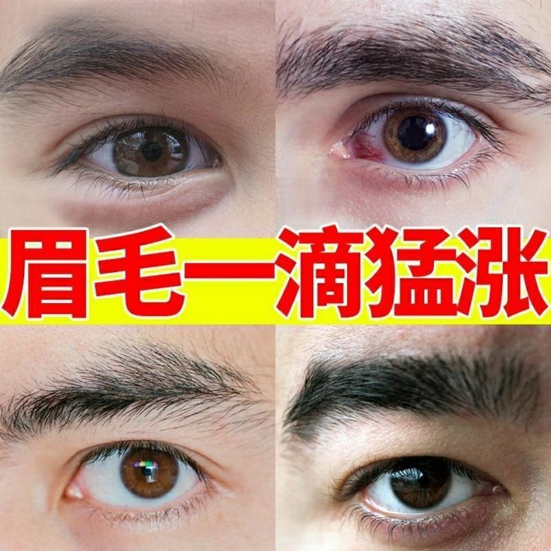 阿琪思毛发滋养液 毛发增长液胡须生长液胡子发际线鬓角络腮胡眉毛浓密头发增毛膏