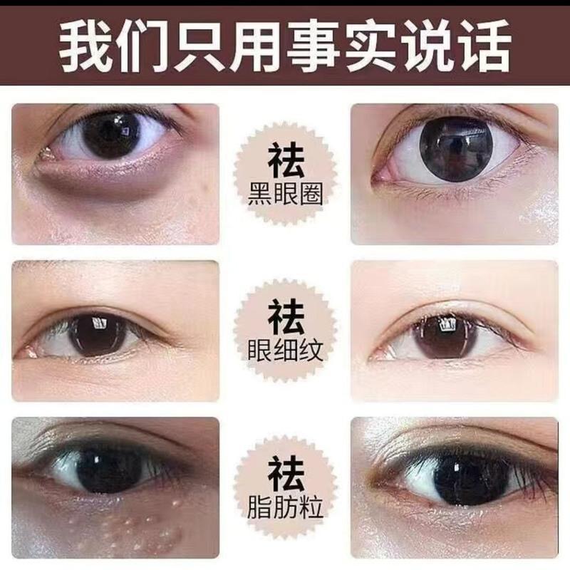[1盒8片] 缓解眼部疲劳 燕窝酵母眼膜贴去眼袋黑眼圈祛眼袋去眼纹淡化眼细纹去皱补水眼贴