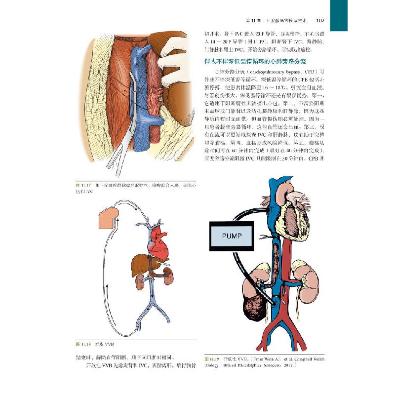 醉染图书辛曼泌尿外科手术图解(第4版) 彩色版9787565956高清大图