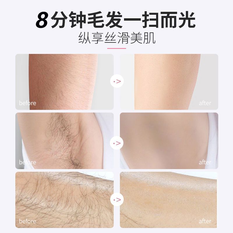 脱毛膏女学生去毛腿毛根腋毛私密处脱毛神器永全身久可用不留黑点 脱毛膏大容量100g[推荐]