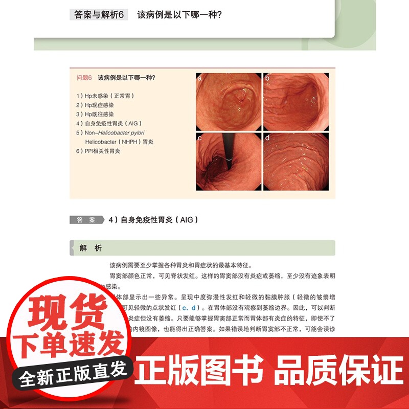 书出版社]胃炎的成因--内镜诊断的历史与未来 自身免疫性胃炎AIG非幽门螺杆菌胃炎NHPH胃炎内镜诊断 辽宁科学技术出版高清大图