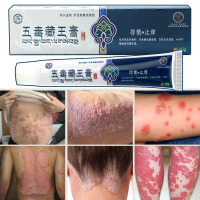 五毒藏王膏苗药狼毒治湿疹股藓牛皮癣疥疮药头皮癣毛囊炎龟头炎药外阴瘙痒止痒药膏湿毒清银屑病皮肤过敏外用真菌感染药15克/盒