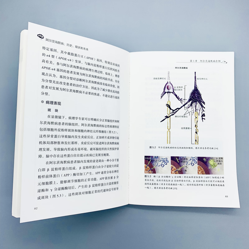 [醉染正版]阿尔茨海默病历史现状和未来 全面认识阿尔茨海默病一本通预防逆转老年痴呆新治疗方法神经科医学科普百科书籍 世界高清大图