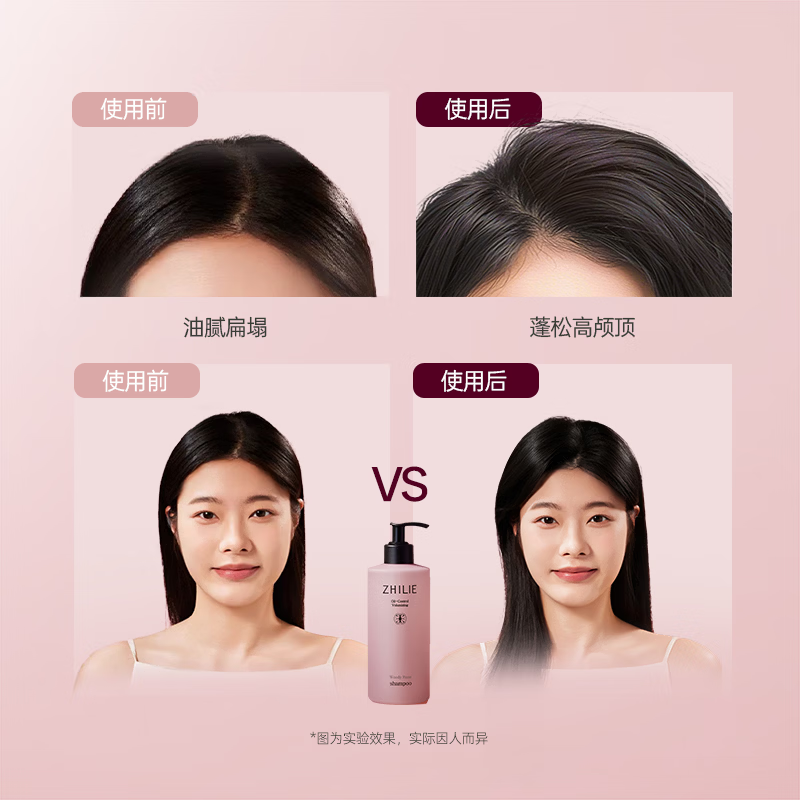 质里控油蓬松洗发水松木玫瑰(400ml+200ml+20ml)高清大图