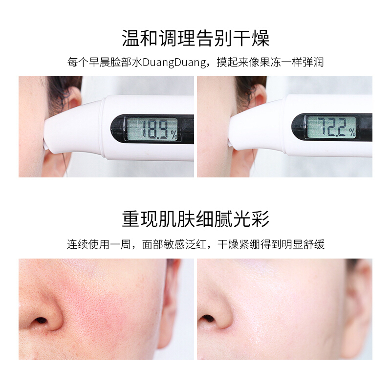 金盏花爽肤水金盏花肌润保湿舒缓精华水化妆水补水湿敷修护爽肤水护肤品 120ml
