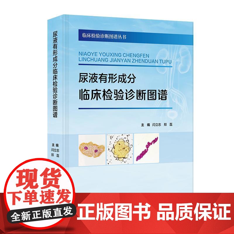 尿液有形成分临床检验诊断图谱高清大图