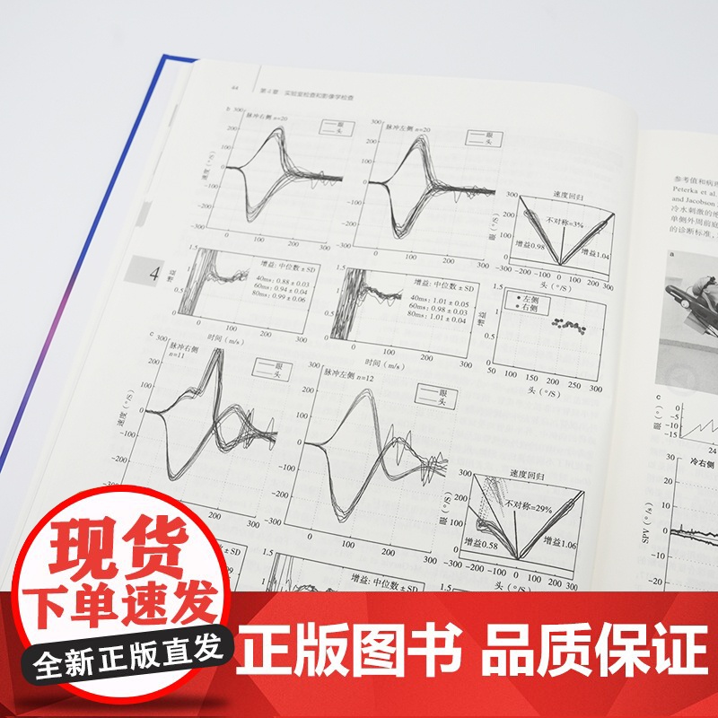 眩晕和头晕常见疾病第3版内科学前庭神经系统解剖学眼运动综合征耳石症耳鸣生理学失衡基础病辅助检查诊断鉴别治疗新进展人卫书籍高清大图