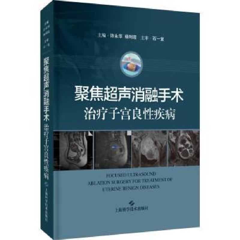 音像聚焦超声消融手术治疗子宫良疾病(精)许永华,杨利霞