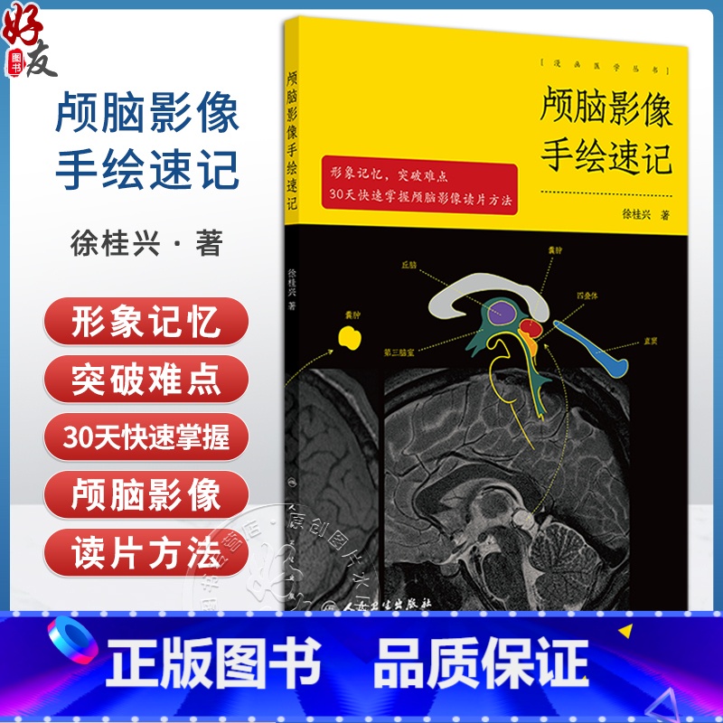 颅脑影像手绘速记 颅脑正常影像 高血压性脑出血 脑静脉出血和静脉窦血栓形成 颅内肿瘤 主编 徐桂兴 9787117 【正