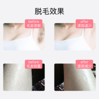 佳禾美激光脱毛仪 全身家用冰点腋下毛私处剃毛刀去毛器 持久光子除毛机器HM-C4
