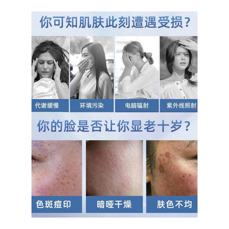 5片装 南方医学研究院嫩白淡斑面膜淡斑点亮肤色