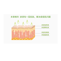 同仁堂祛痘膏组合男女祛痘产品(祛痘精华30g+祛痘膏30g)草本配方控油补水