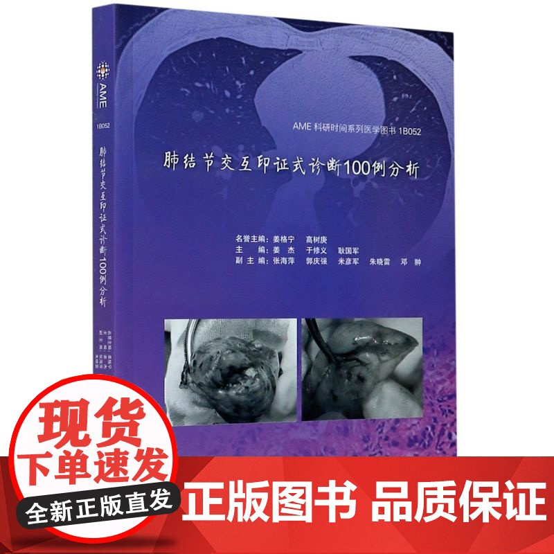 肺结节交互印证式诊断100例分析高清大图