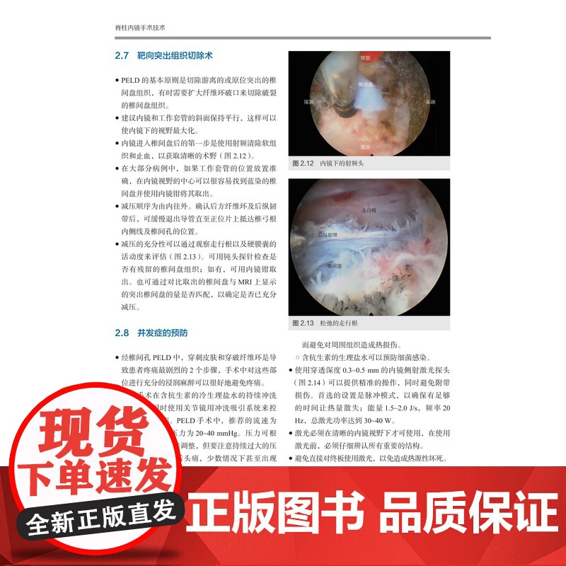 脊柱内镜手术技术 视频配合学习 外科手术图解 临床应用 手术技巧分析 病例分析 北京科学技术高清大图