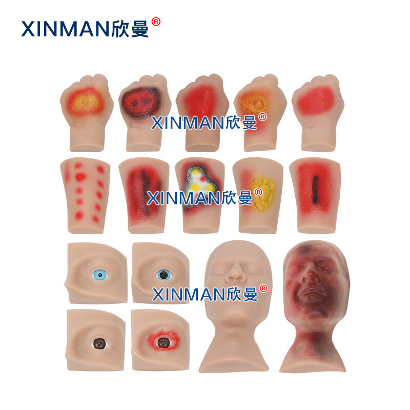 欣曼科教 人员中毒仿真模型 神经性中毒 芥子气中毒 路易氏剂中毒 教学用模型XM-SQ16A高清大图