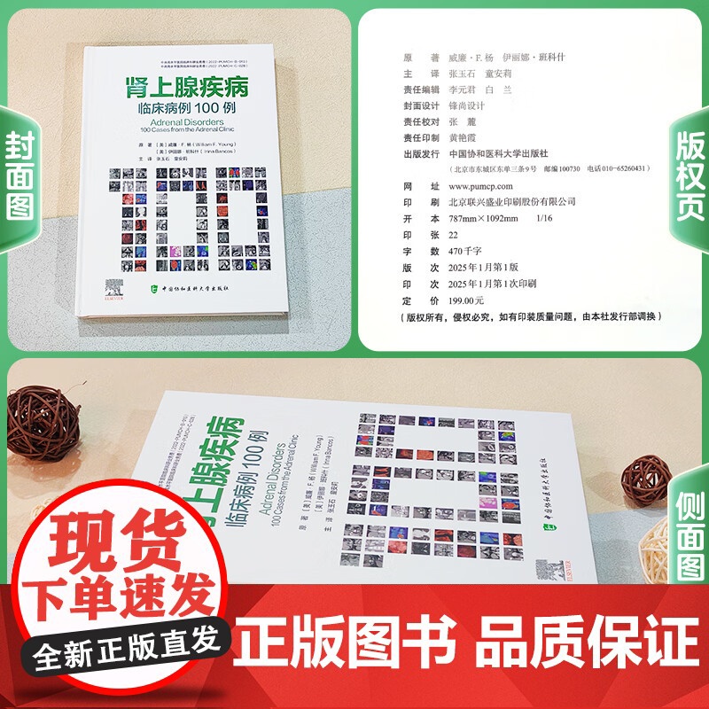 肾上腺疾病临床病例100例 张玉石 童安莉主译 基于病例的方法来评估和治疗常见和不常见的肾上腺疾病 中国协和医科大学出版高清大图