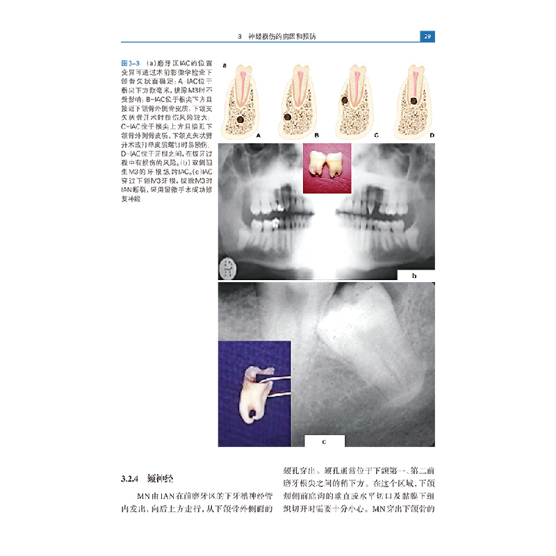 醉染图书三叉神经损伤9787519264024高清大图