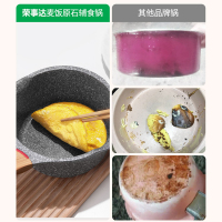 荣事达(Royalstar)麦饭石小奶锅18cm宝宝婴儿辅食锅煎煮一体家用不粘热奶泡面燃气电磁炉通用RA13220402