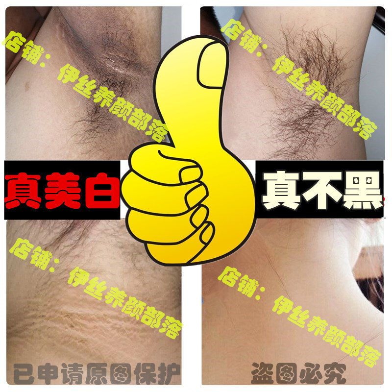 去黑色素脖子腋下美白颈部脸上嘴角天生黑晒黑大腿根男女学生孕妇 一瓶装