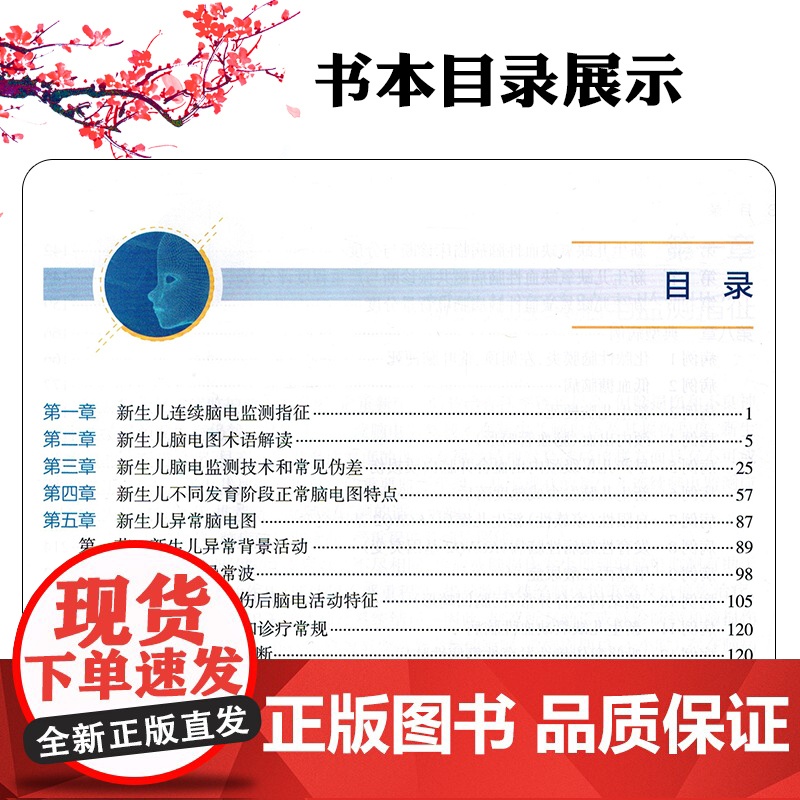 新生儿连续脑电监测图形快速判读(第2版) 人民卫生出版社9787117376990高清大图