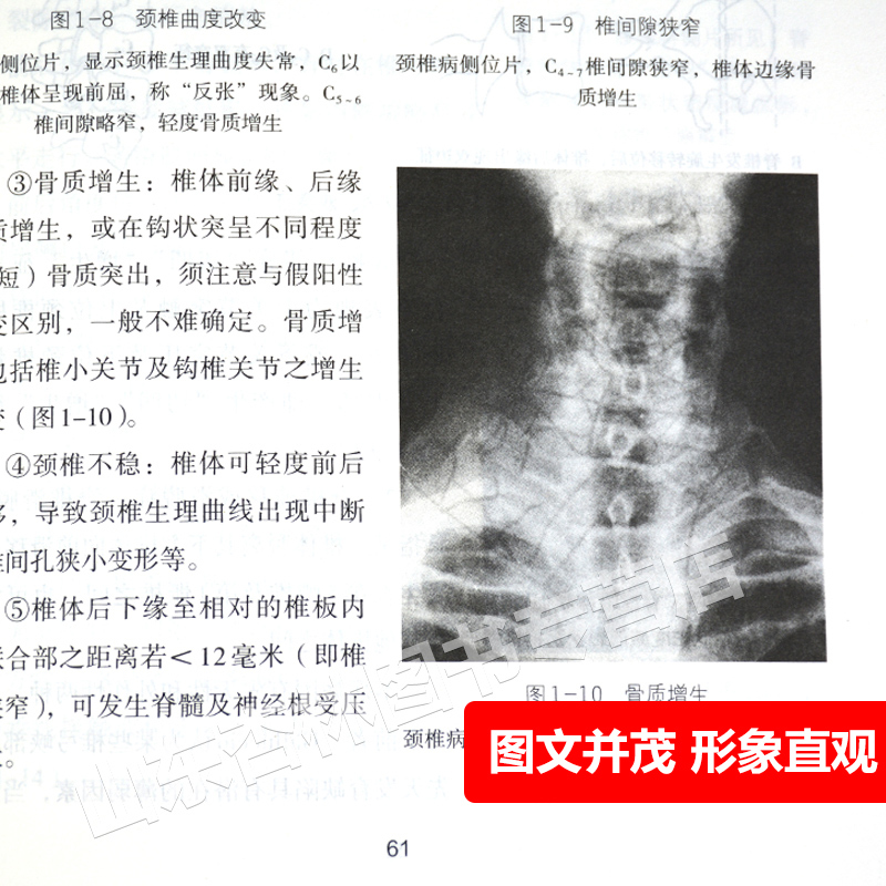 错骨缝与筋出槽治疗术 [正版] 错骨缝与筋出槽中医诊疗术+筋伤手法治疗术 田纪钧手法妙术系列丛书田纪钧著 人民卫生出版社