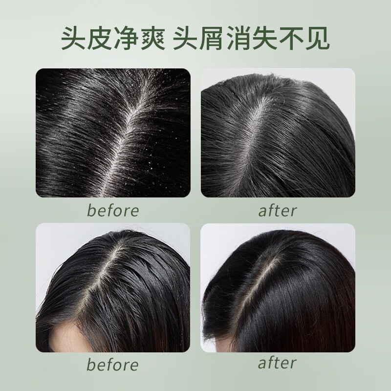 菲诗蔻(FicceCode)桉树洗发水300ml去屑控油洗发露持久柔顺洗头膏澳洲进口高清大图